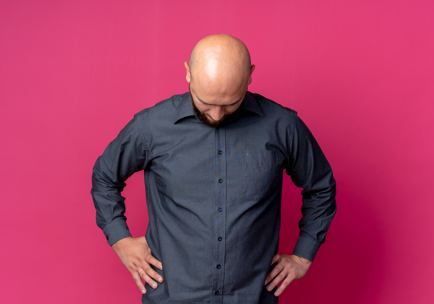 CHAMAR ALGUÉM DE CARECA PODE SER ASSÉDIO? DECISÃO DA JUSTIÇA BRITÂNICA DIVIDE OPINIÕES